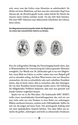 Am I Just My Brain? (German)